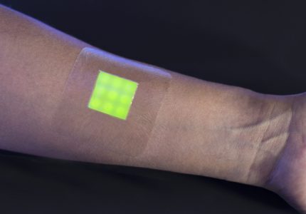 Smartwound Infection detecting wound dressing